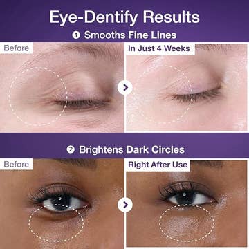 No.9 NAD+ Retinol Volumetox Eye Cream 10ml — product view 4