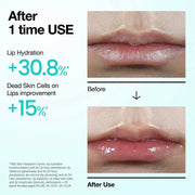 Anua PDRN Lip Serum 10ml — view 3
