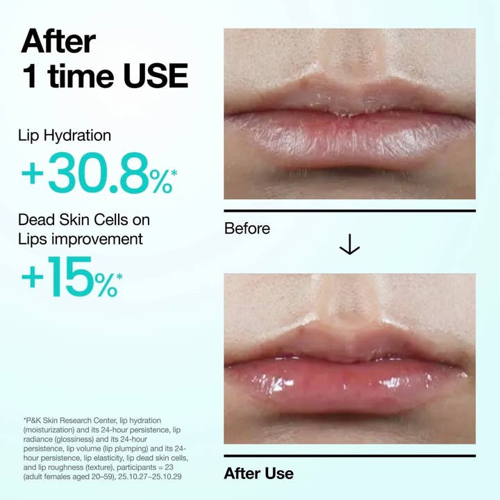 Anua PDRN Lip Serum 10ml — view 3