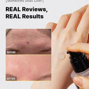 Advanced Snail 96 Mucin Power Essence 100ml — product view 5