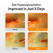 Glutathiosome Dark Spot Serum Vita Drop 50ml — product view 5