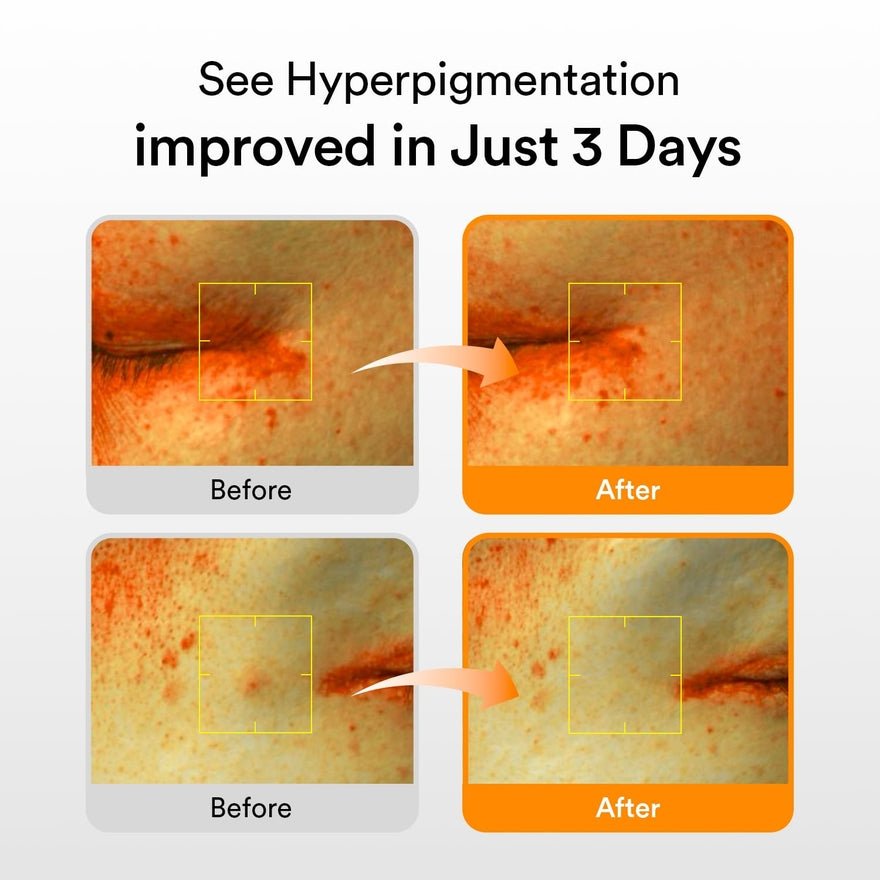 Glutathiosome Dark Spot Serum Vita Drop 50ml — product view 5
