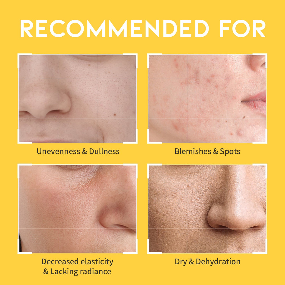 Dark Spot Vitamin C Toner 250ml — product view 6