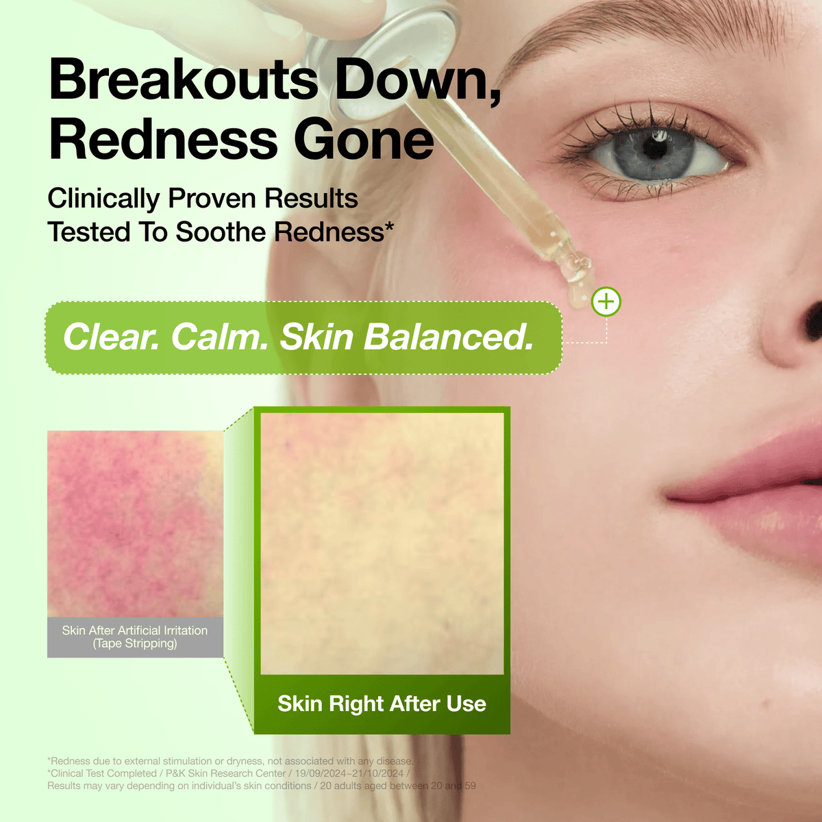 Azelaic Acid 10% Hyaluron Redness Soothing Serum — product view 17