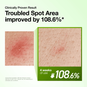 Azelaic Acid 10% Hyaluron Redness Soothing Serum — product view 16