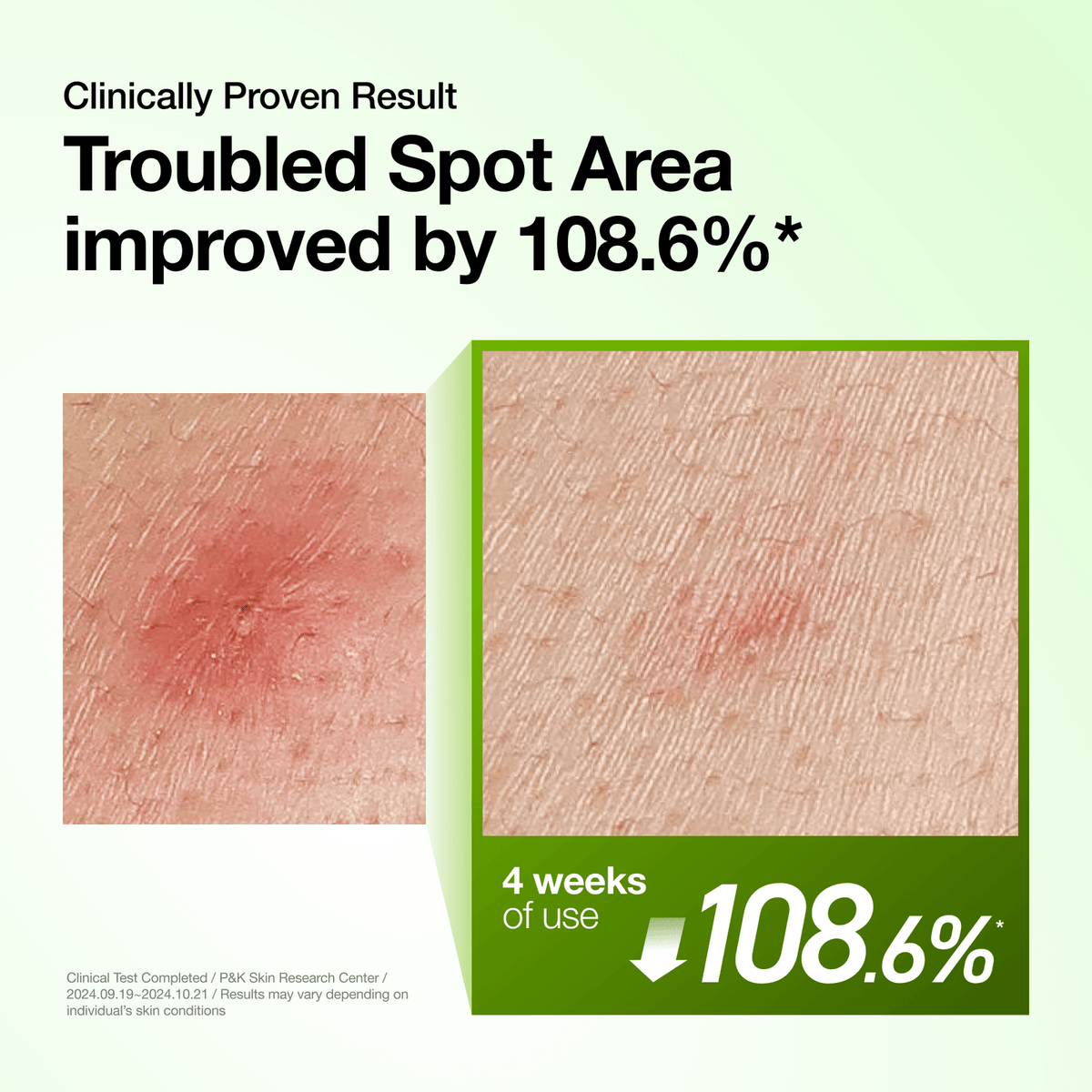 Azelaic Acid 10% Hyaluron Redness Soothing Serum — product view 16