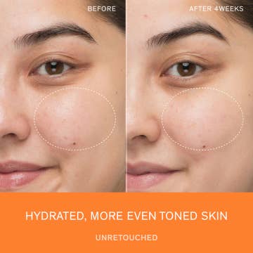 First Care Activating Serum VI Mini 15ml — product view 8