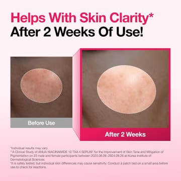 Niacinamide 10% + TXA 4% Serum — product view 5