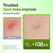 Azelaic Acid 10% Hyaluron Redness Soothing Serum — product view 6