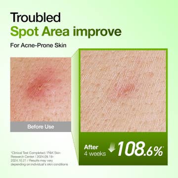 Azelaic Acid 10% Hyaluron Redness Soothing Serum — product view 6